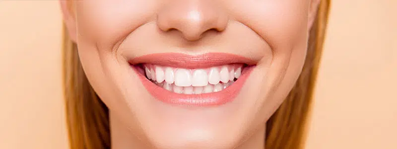 牙齒美白貼片 牙齒美白貼片